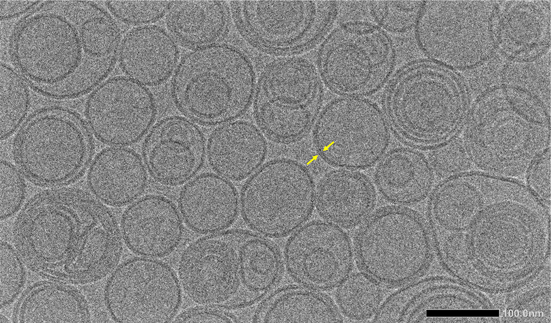 TEM image of Liposome lipid bilayer membrane.