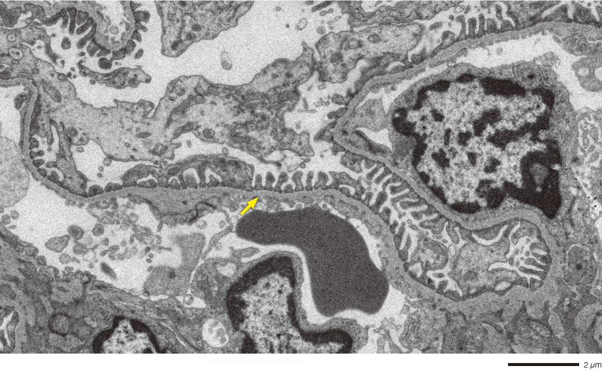 TEM image of mouse kidney.