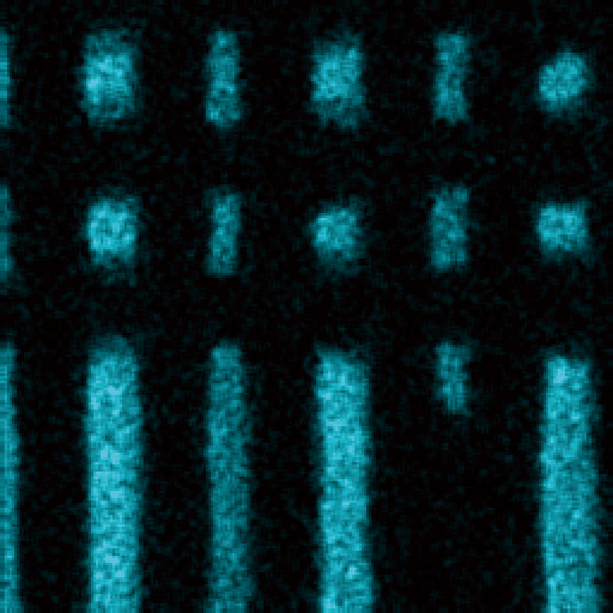 Fig. 3 W net count map by Dose Painting using the mask from Fig. 2