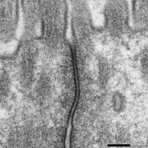 Fig. 1 TEM Image of Tight Junction